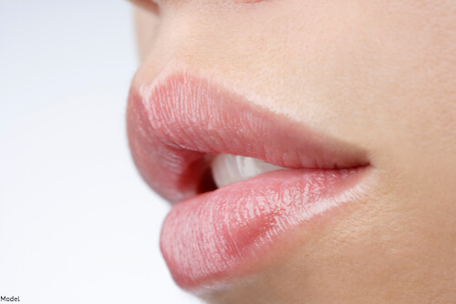 Plump lips after a lip filler session